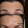 Image 3: Smooth & Plump: Botox and Juvéderm Custom Aesthetic Packages