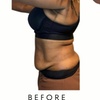 Image 5: Precision Slim Laser Fat Loss & Skin Tightening, Your Sculpt Studio DC