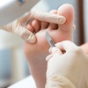 Image 3: Step Smoothly: Renew Your Feet with Expert Callus Removal!