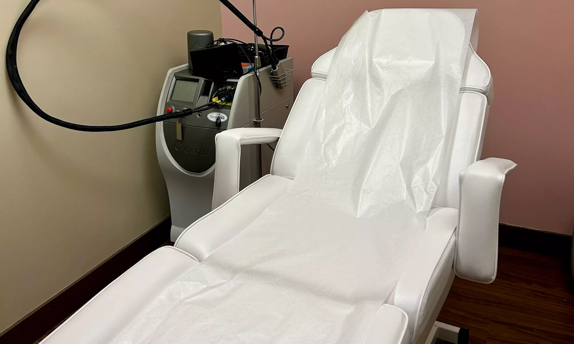 Four Laser Hair Removal Sessions Small Area - 10, 20 or 15-Mins Each