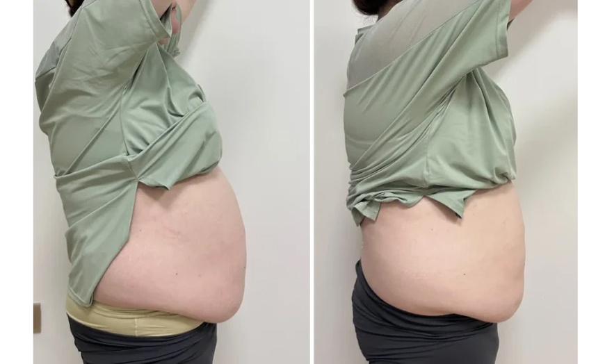 Image 4: 4 or 6 30-Minute Cavitation / 4 60-Minute Custom Ultrasonic Cavitation