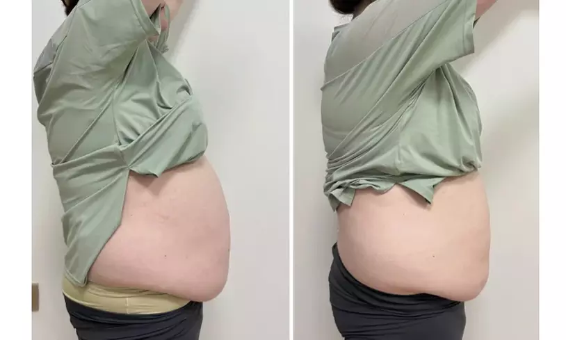 4 or 6 30-Minute Cavitation / 4 60-Minute Custom Ultrasonic Cavitation
