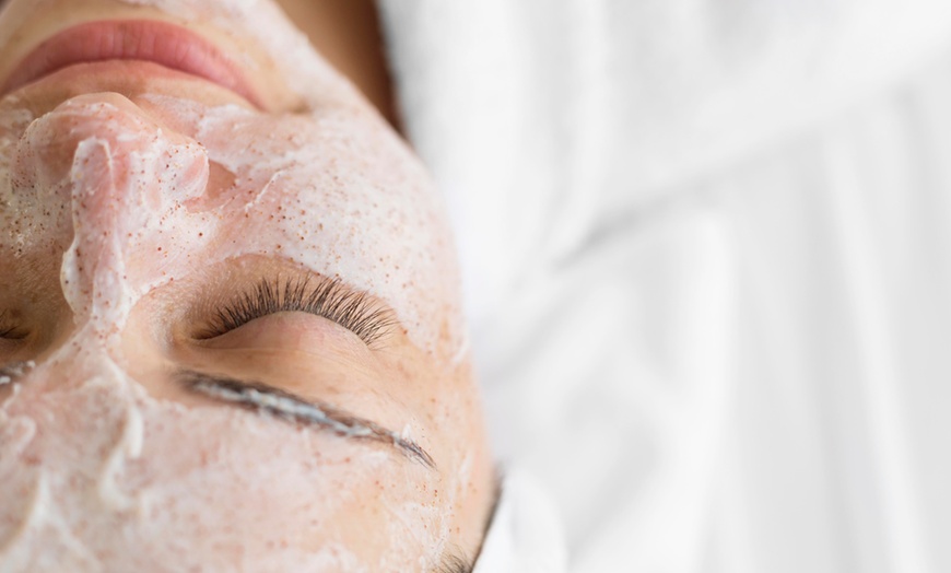 Image 3: Sesión de microneedling de labios o facial con activos hidratantes 