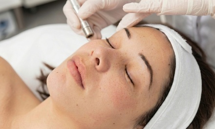 One Microdermabrasion Treatment - AW Skin and Balance Omni Salon Suites