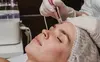 Transform Your Skin with One or Three Sessions of PRP Facial at Bella Sol Med Spa (Up to 71%Off)