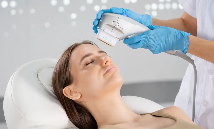 Image 3: Advanced IPL/Photofacial Stellar M22 for Clearer, Radiant Skin