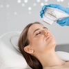 Image 3: Advanced IPL/Photofacial Stellar M22 for Clearer, Radiant Skin