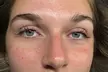 Transform Your Look with One Eyelash Tinting and Lift Treatment at PureSkin Esthetics ( Up to 55% Off ) - Second Medium
