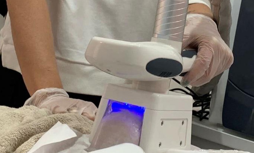 Image 4: Sesiones de presoterapia, con opción a criolipólisis, para 1 persona