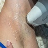 Image 2: 6 Laser Hair Removal Sessions on Small, Medium, or Large Area