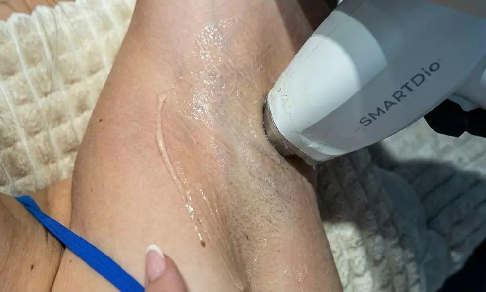 6 Laser Hair Removal Sessions on Small, Medium, or Large Area