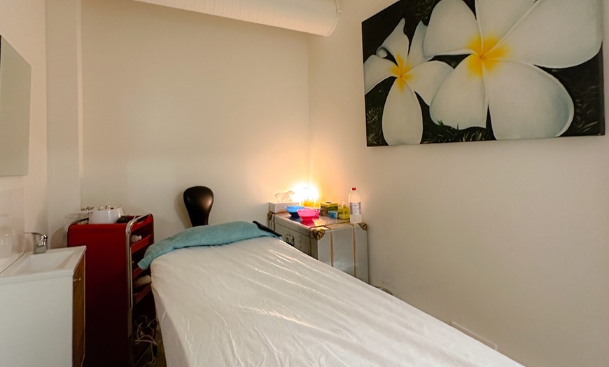 Image 2: 1 o 2 sesiones de exosomas con dermapen en rostro completo 