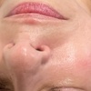 Image 3: Radiant Skin with Dermaplaning and More Options
