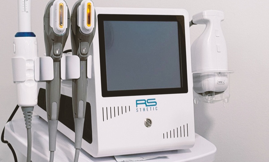 Image 12: Tratamiento de rejuvenecimiento facial con 10 o 20 hilos tensores PDO