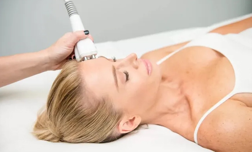 Image 1: Venus Freeze Non-Surgical Tightening - Face, Neck, or Body 