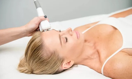 Venus Freeze Tightening - Full Face - Fairmount Spa