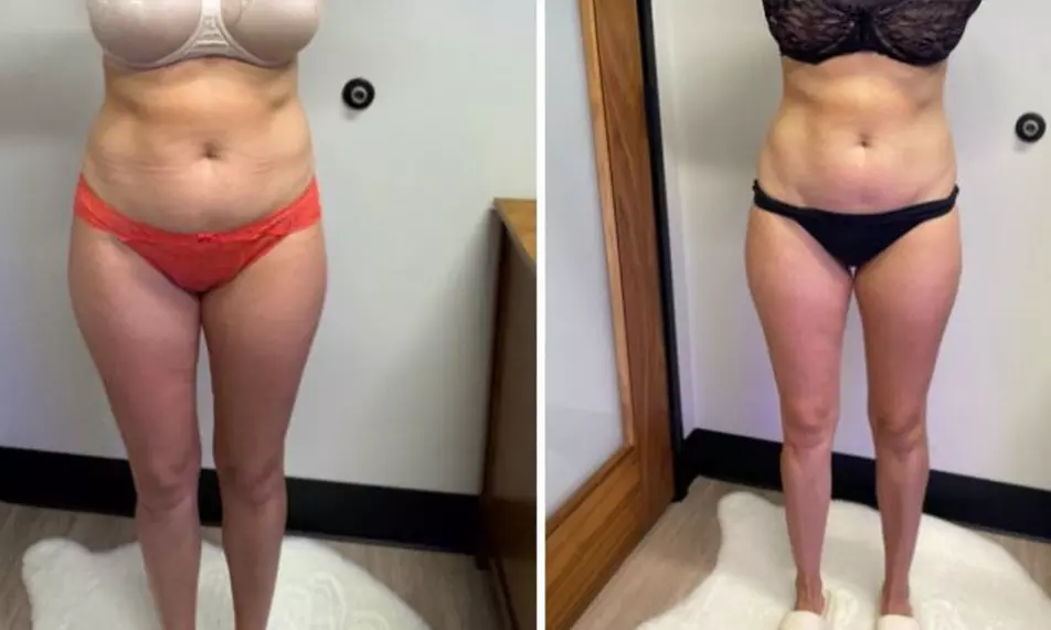 Sculpt, Tone, And Glow with 30,45,60,or 90-Min Sculpting Sessions