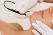 Get Smooth with One or Two 30-Minute Electrolysis Hair Removal Sessions At Chicago Epilation(Up to 32% Off) - Second Medium
