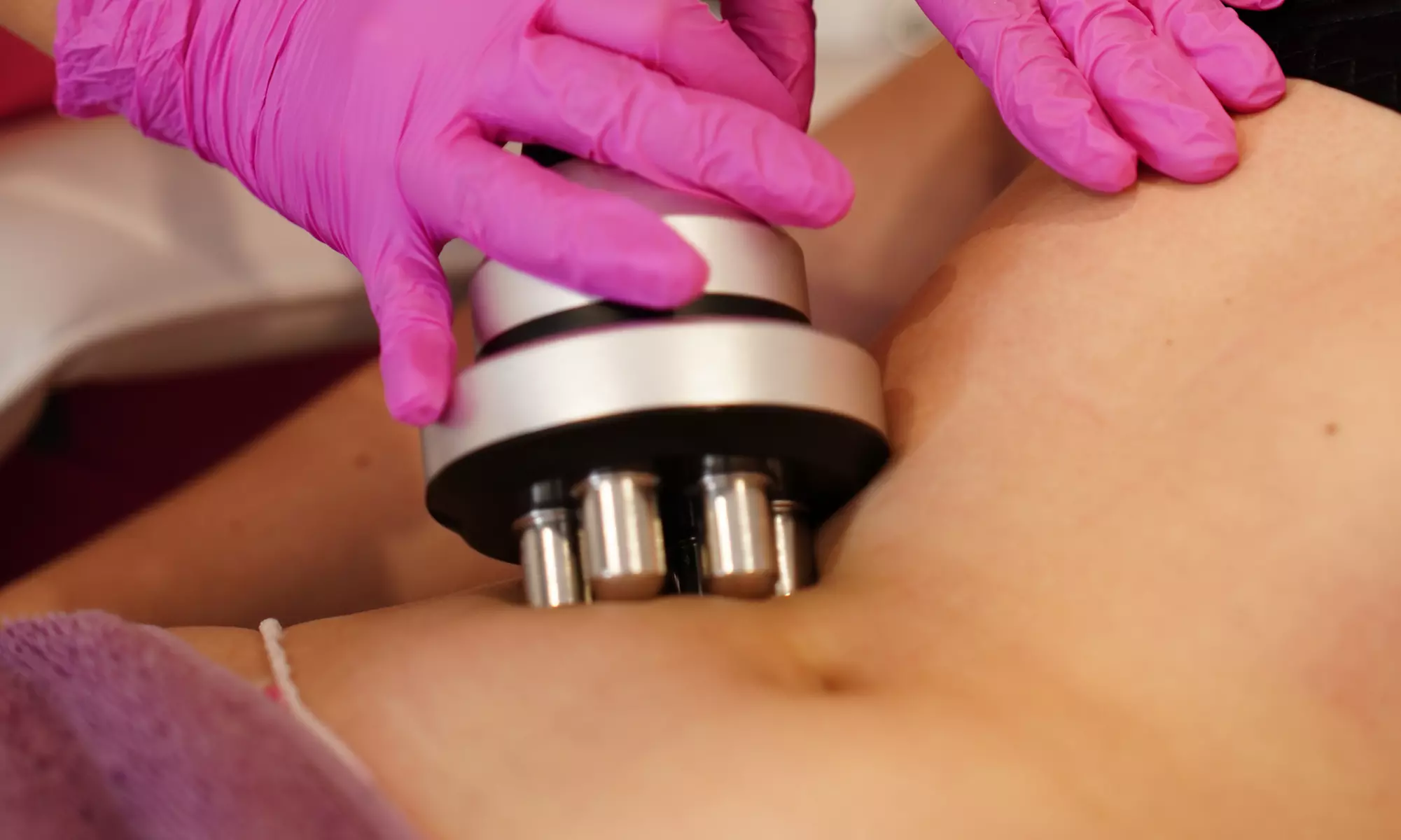 Wyszczuplający EMS, lipolaser, fale radiowe, dermomasaż, endosfera