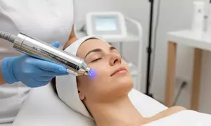 Tratamiento renovador facial HC3 Skinshooter o lHialurox en Clínicas Láser Fusión Carranza (hasta 58% de descuento)