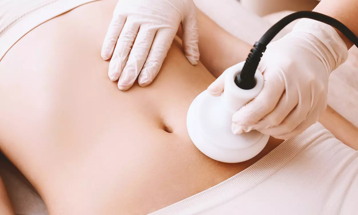 Transform Your Body with One, Five, or Ten Ultrasonic Cavitation Sessions @VJ Body Sculpting (Up to 55%Off) - Primary Image