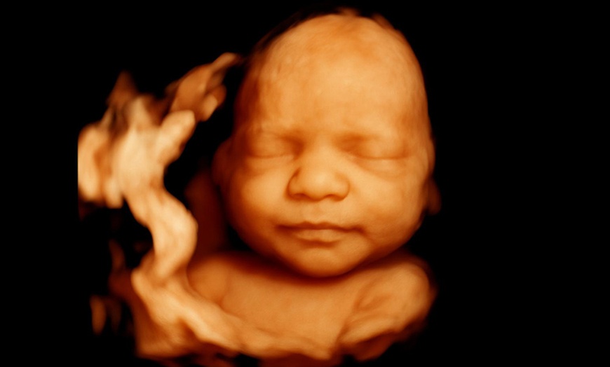 Image 3: Ecografía 4D-5D emocional básica o plus para conocer a tu bebé