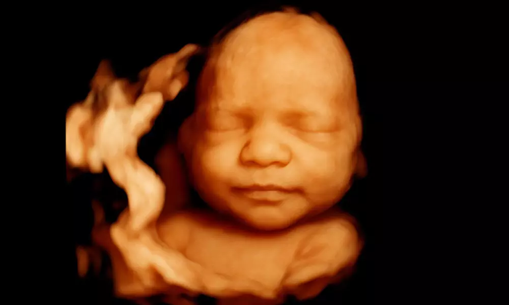 Tu bebé más cerca: ecografía 4D-5D emocional básica o plus