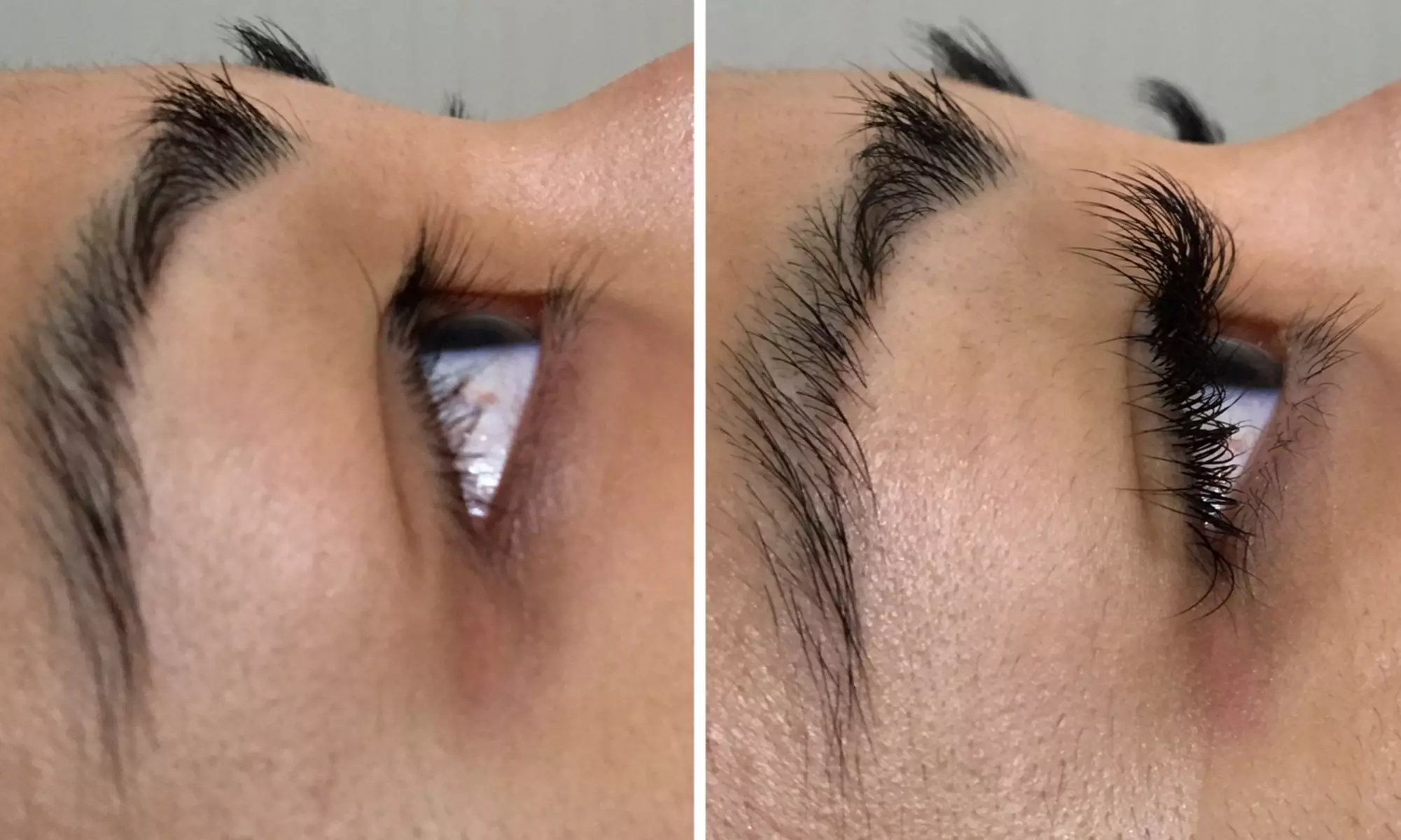 Classic, Volume or Hybrid Extensions or Classic Extensions with Fill