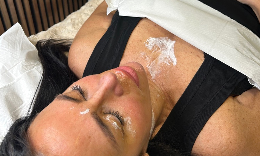 Image 2: Up to 64% Off on Facial - Peeling at Jems Laser & Aesthetics Liverpool Limited