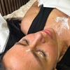 Image 2: Up to 64% Off on Facial - Peeling at Jems Laser & Aesthetics Liverpool Limited