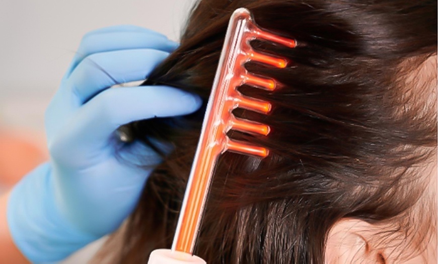 Image 6: Tratamiento capilar regenerativo con alta frecuencia