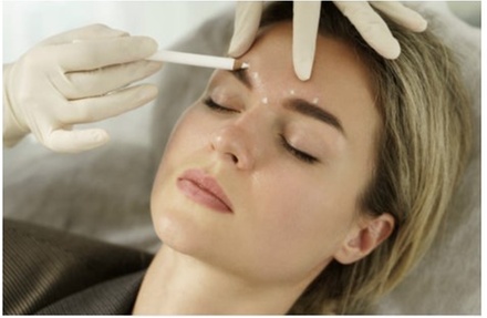 10 Units Of Botox - The Beauty Concierge MD