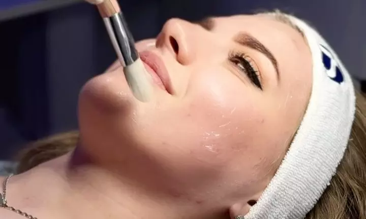 Zachte huidvernieuwing: facial peeling van 45 minuten