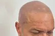 2 or 4 Hour Scalp Micropigmentation for Hairline, Crown or Full Scalp Restoration at Authentic SMP(Up to 33%Off) - Second Medium