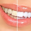 Image 1: Brighter Smiles: 1–3 Professional Teeth Whitening Sessions 