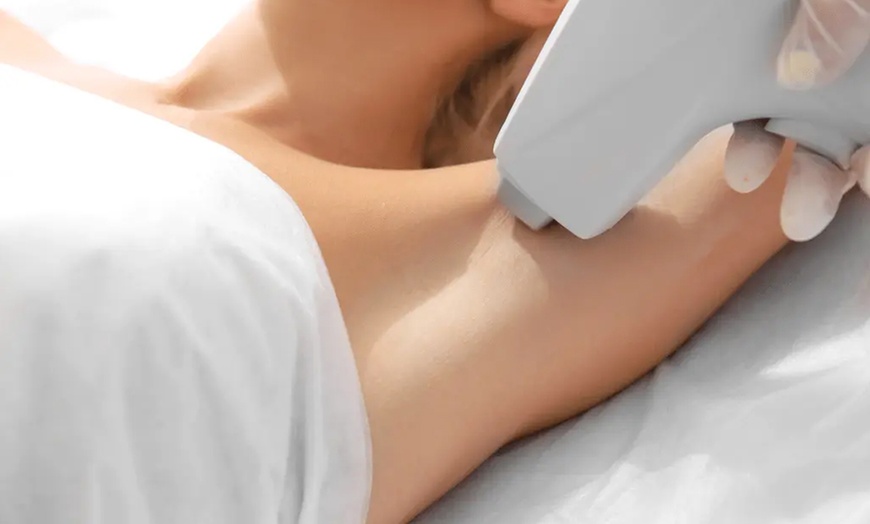 Image 2: 3 Laser-Haarentfernungen an einer kleinen oder mittleren/großen Zone