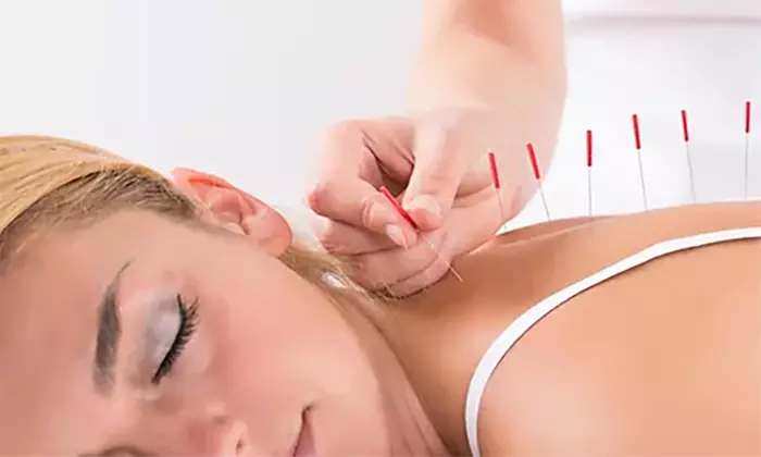 Holistic wellness with Facial or First Acupuncture Session with initial consultation (Up to 50% Off) - Primary Image