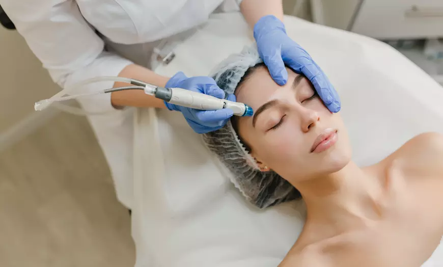 Image 1: 1 o 2 sesiones de radiofrecuencia facial y punta de diamante 