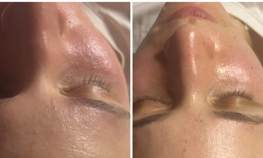 Image 4: Soin du visage hydratant, anti-âge ou coup d'éclat chez Mybodyfull