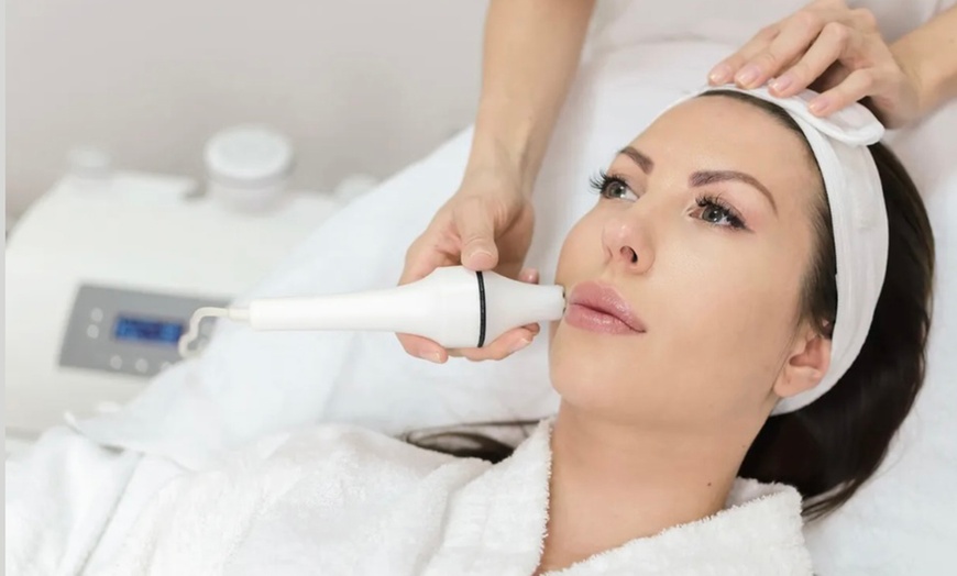 Image 1: Up to 30% Off on Facelift - Non-Surgical at Skinfinity