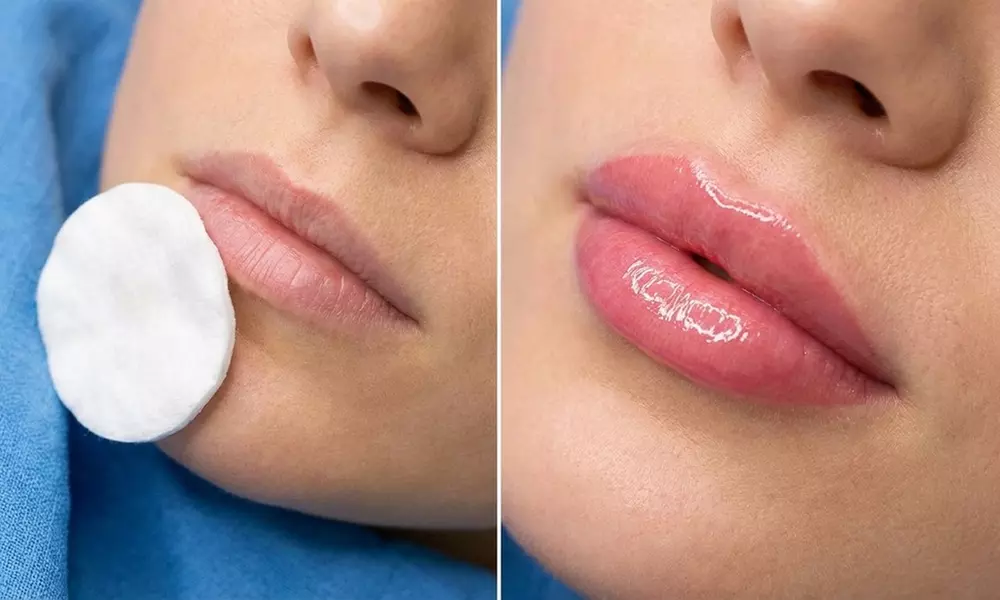 Get One Microblading Session, Ombre Microshading Session, & Lip Blush