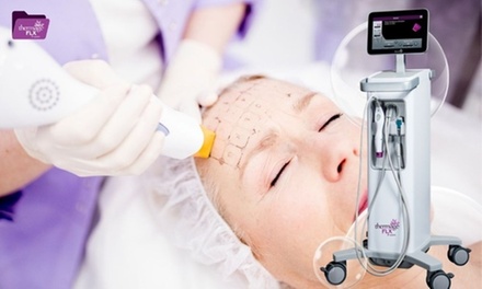 Thermage FLX: Non Surgical Face & Neck Lift - IVE MEDICAL SPA