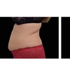 Image 5: One Session Electromagnetic Body Sculpting on One, Two or Four Areas