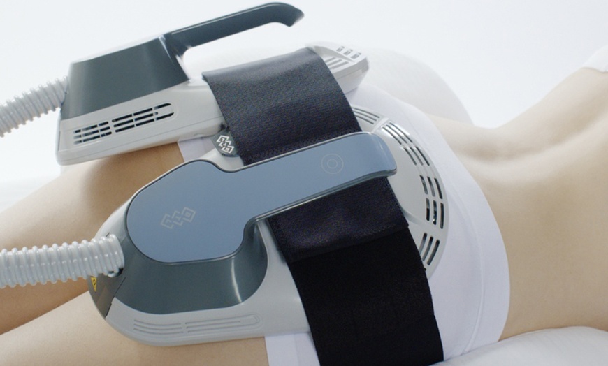 Image 4: Transform w/ One, Six, or Twelve Sessions of EMS Body Sculpting w/ RF