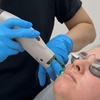 Image 1: Rejuvenate your Complexion with One V-Beam Laser Therapy!