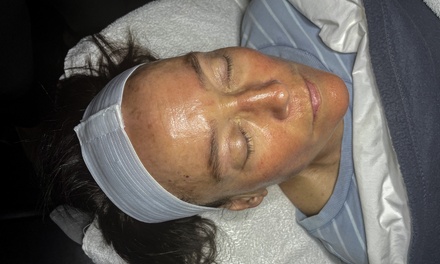 One 75-Minute Signature Facial with Microdermabrasion - Belle Beauty Clinic LLC
