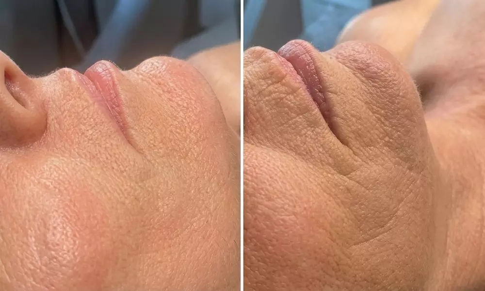 Experience a 60-Minute Buccal Pro-Aging Facial with Add-ons