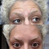 Image 4: Refresh Your Skin with 20, 40, or 60 Units of Neurotoxin