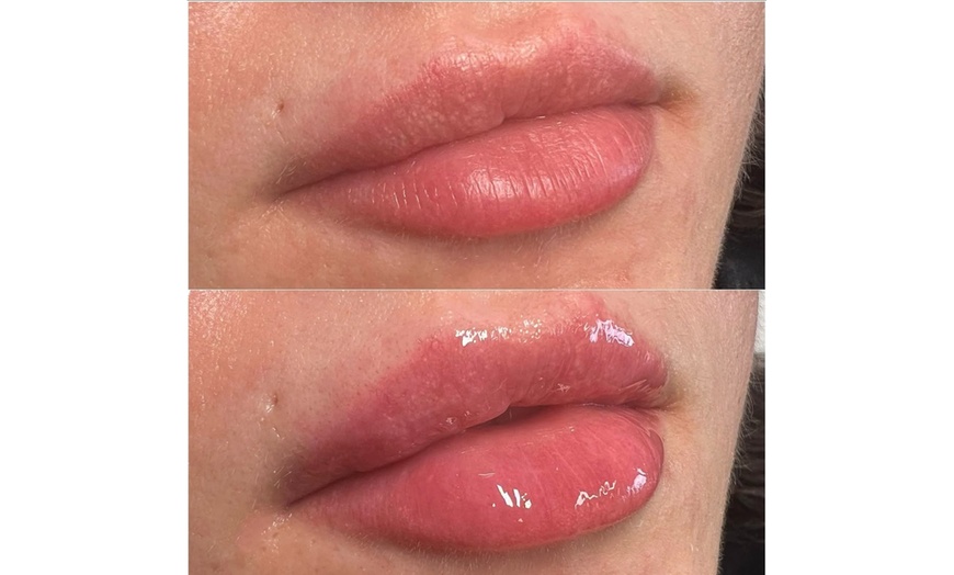Image 7: Hydrating Lip Drip Treatment with/without Color Boost