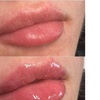 Image 7: Hydrating Lip Drip Treatment with/without Color Boost